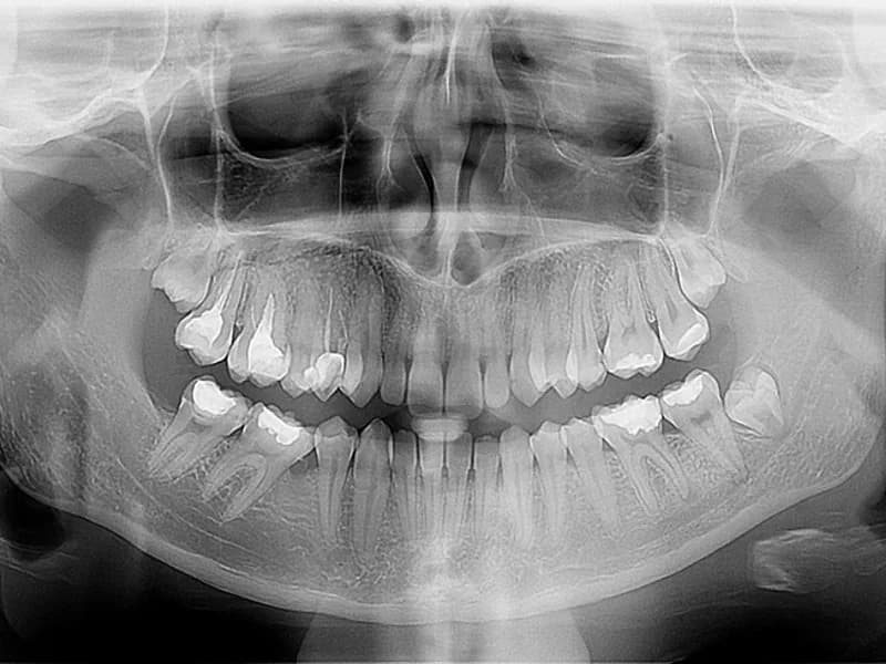 Apex Dental - slika 1