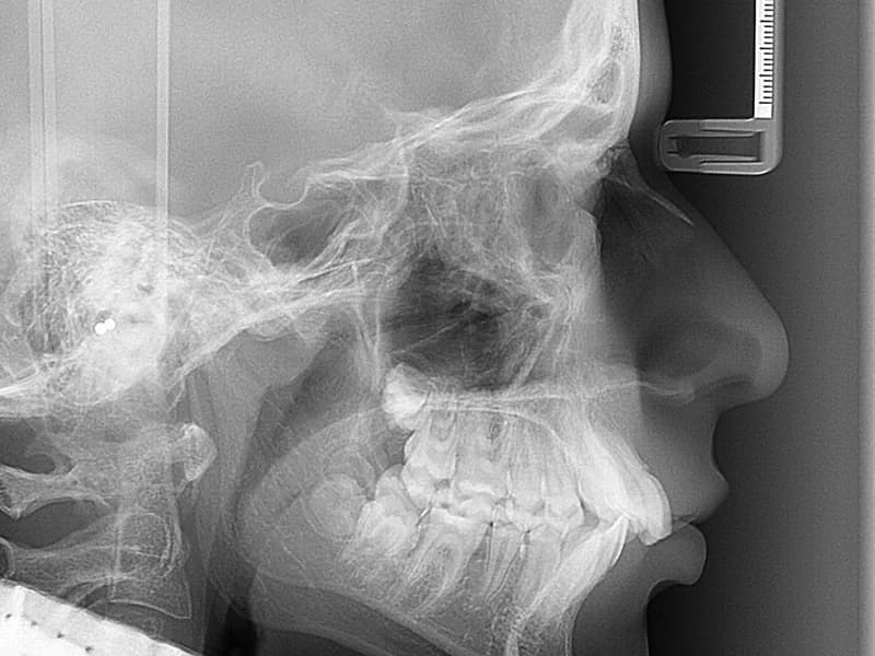 Apex Dental - slika 2