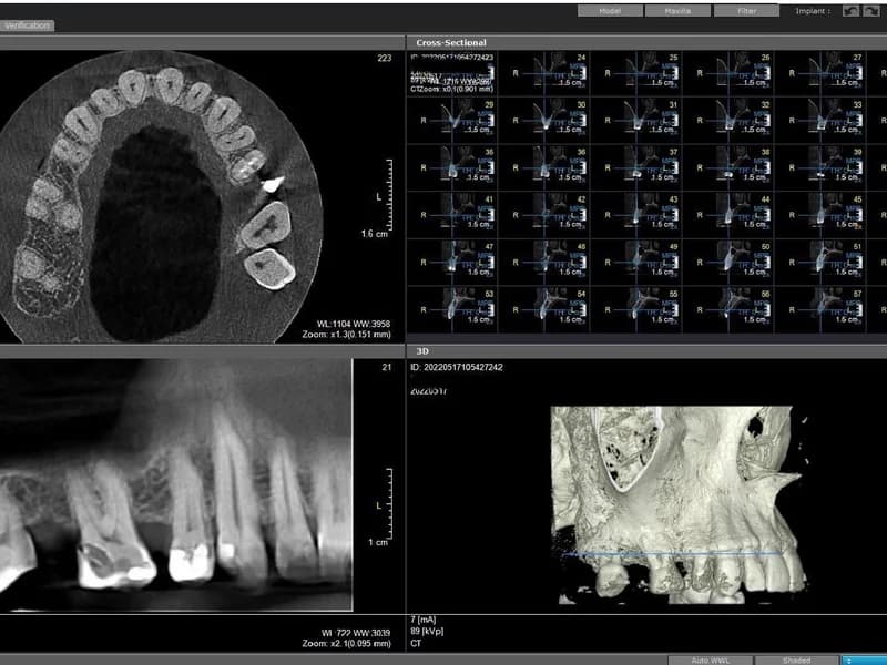 Apex Dental - slika 3