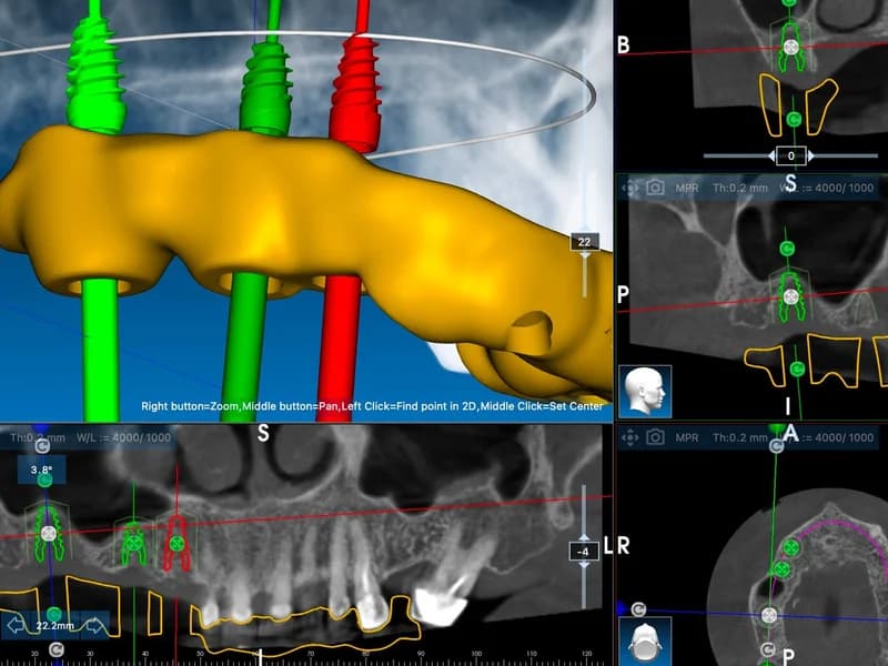 Apex Dental - slika 6