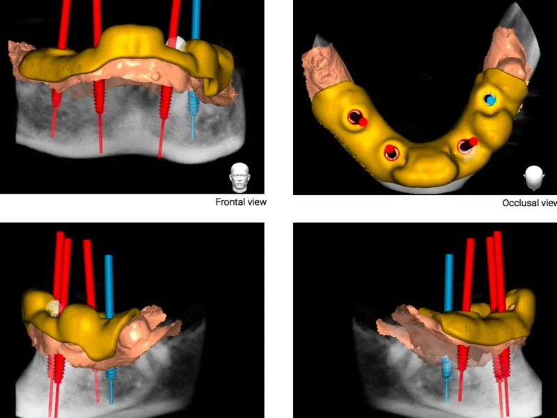 Apex Dental - slika 5
