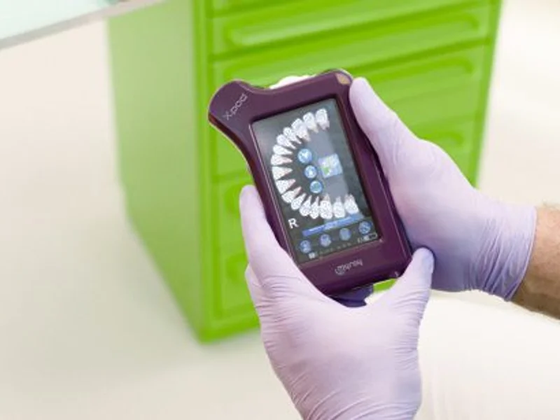 Barlović Dent - slika 1