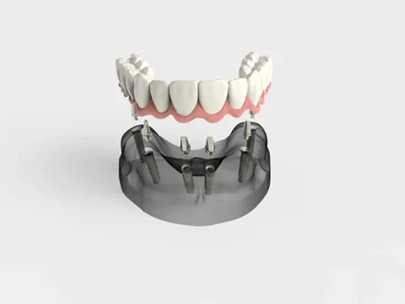 Centrodent - slika 3