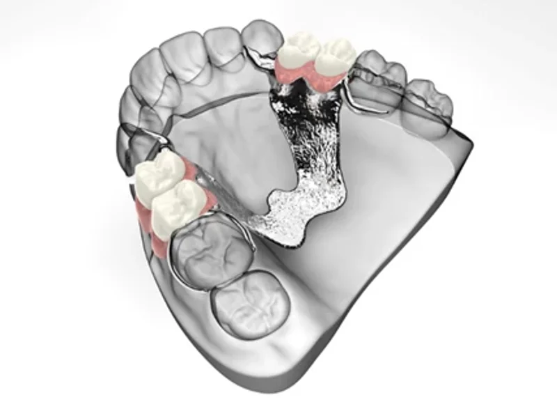 Centrodent - slika 2