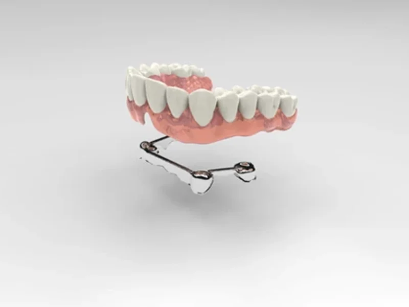 Centrodent - slika 1