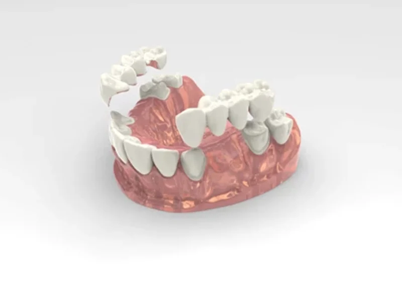 Centrodent - slika 6