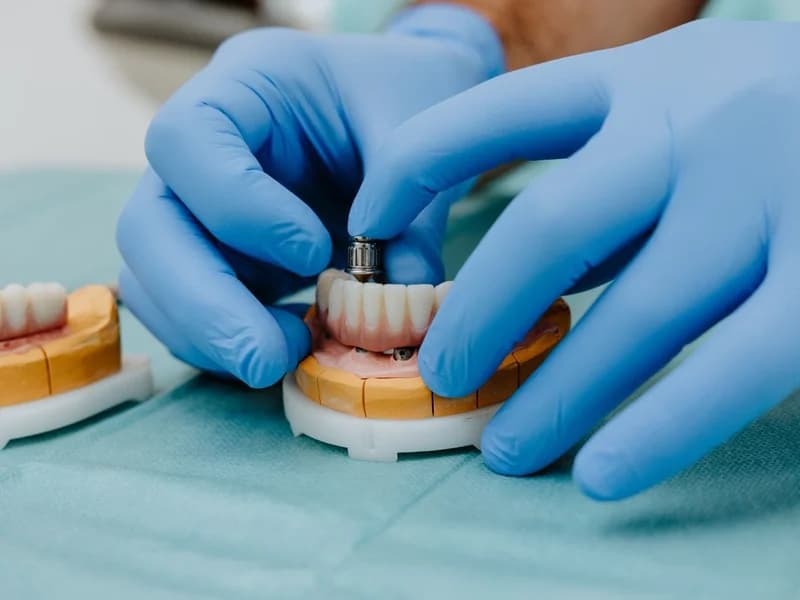 Dental Špehar - slika 6