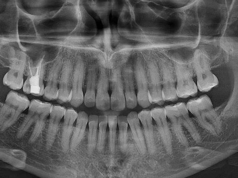 Dentalni rendgen Vukovar - slika 2