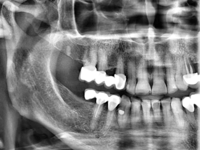 Dentalni rendgen Vukovar - slika 4