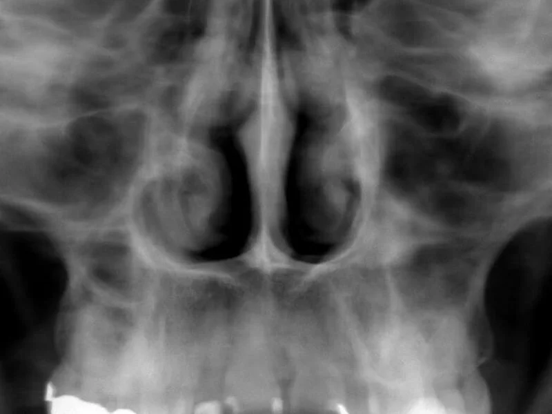 Dentalni rendgen Vukovar - slika 5