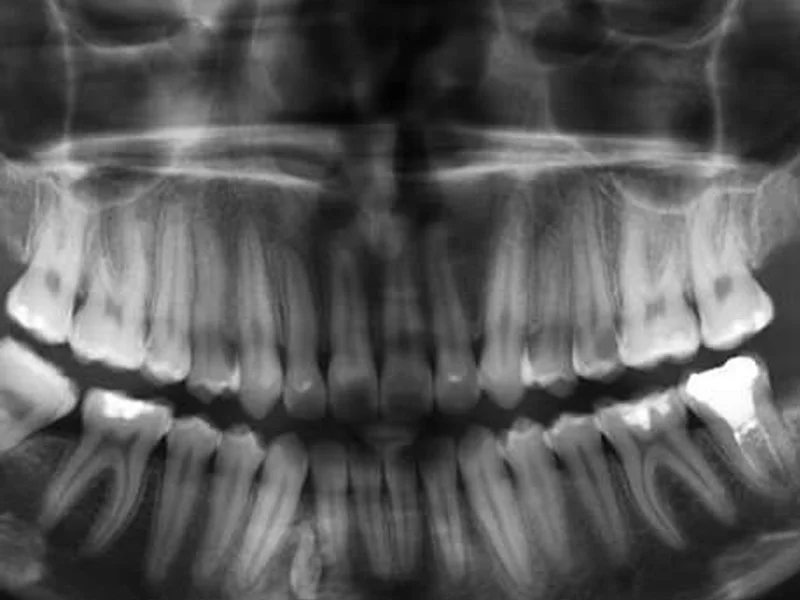 Dentalni rendgen Vukovar - slika 6