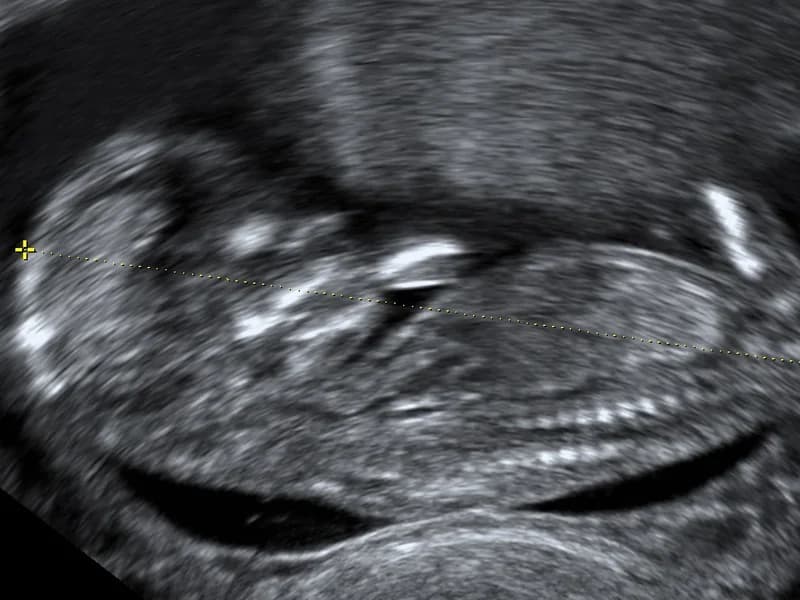 Ginekologija Babić - slika 2