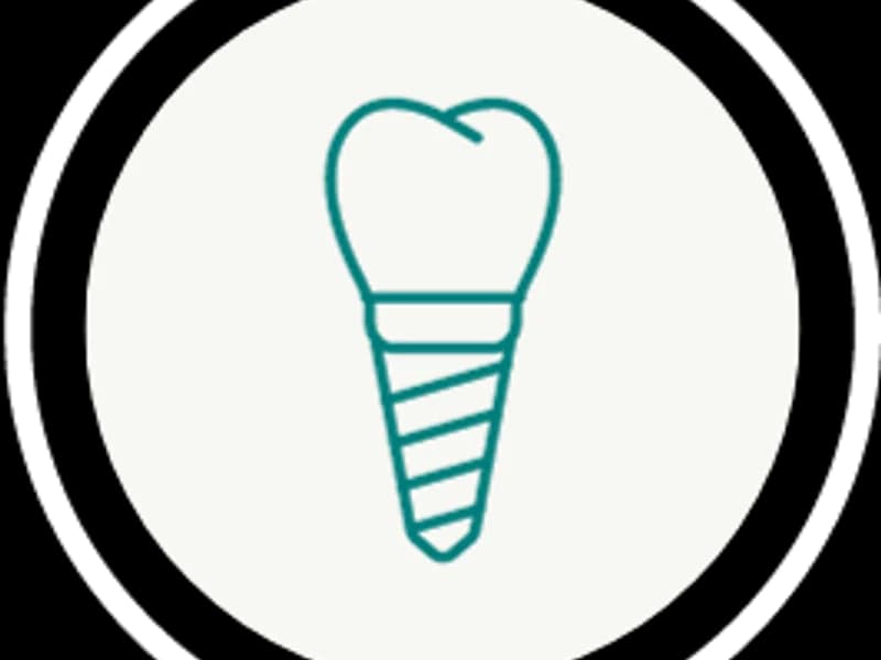 Dental Implants Center - slika 5