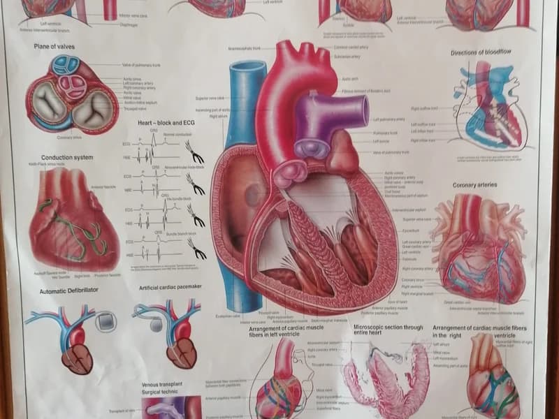 Interna medicina - kardiologija - slika 3