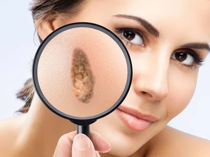 ISTARSKO ZDRAVLJE - slika 3