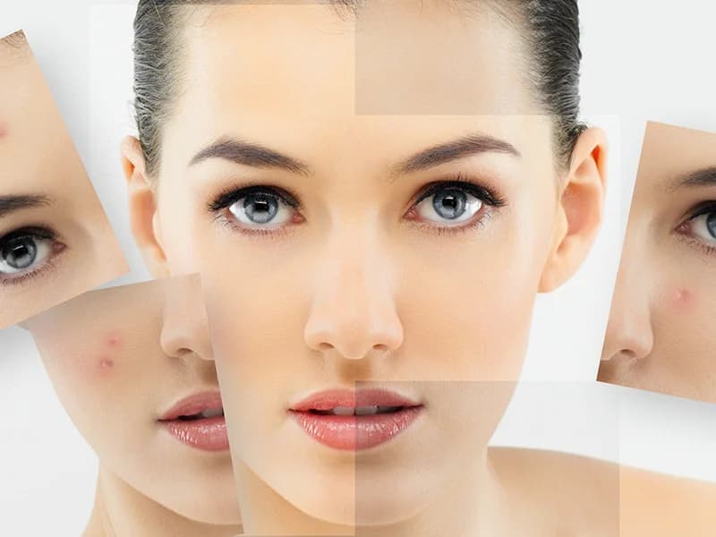 ISTARSKO ZDRAVLJE - slika 4