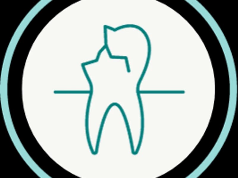 Dental Implants Center - slika 4