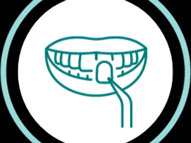 Dental Implants Center - slika 6