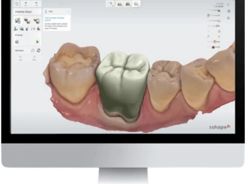 Dental Implants Center - slika 1