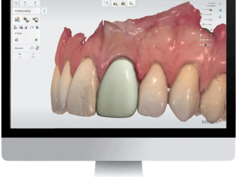 Dental Implants Center - slika 3