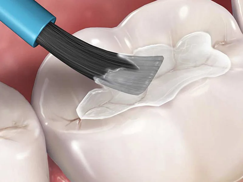 MODERN DENTAL - slika 3