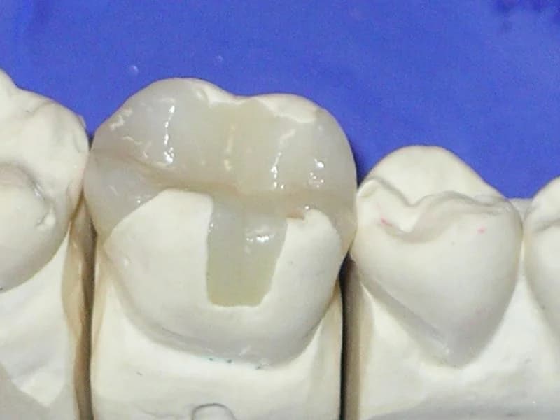 MODERN DENTAL - slika 2