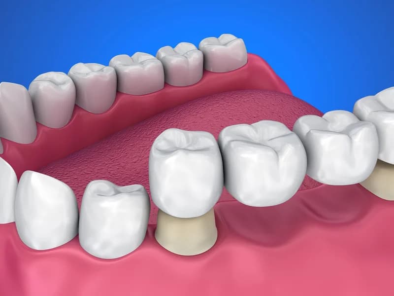 MODERN DENTAL - slika 4